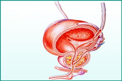 Prostatas iekaisums akūta prostatīta gadījumā ir seksa ierobežojums